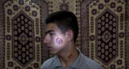 درمان عفونت و التهاب استخوان با نانوکامپوزیت چند منظوره